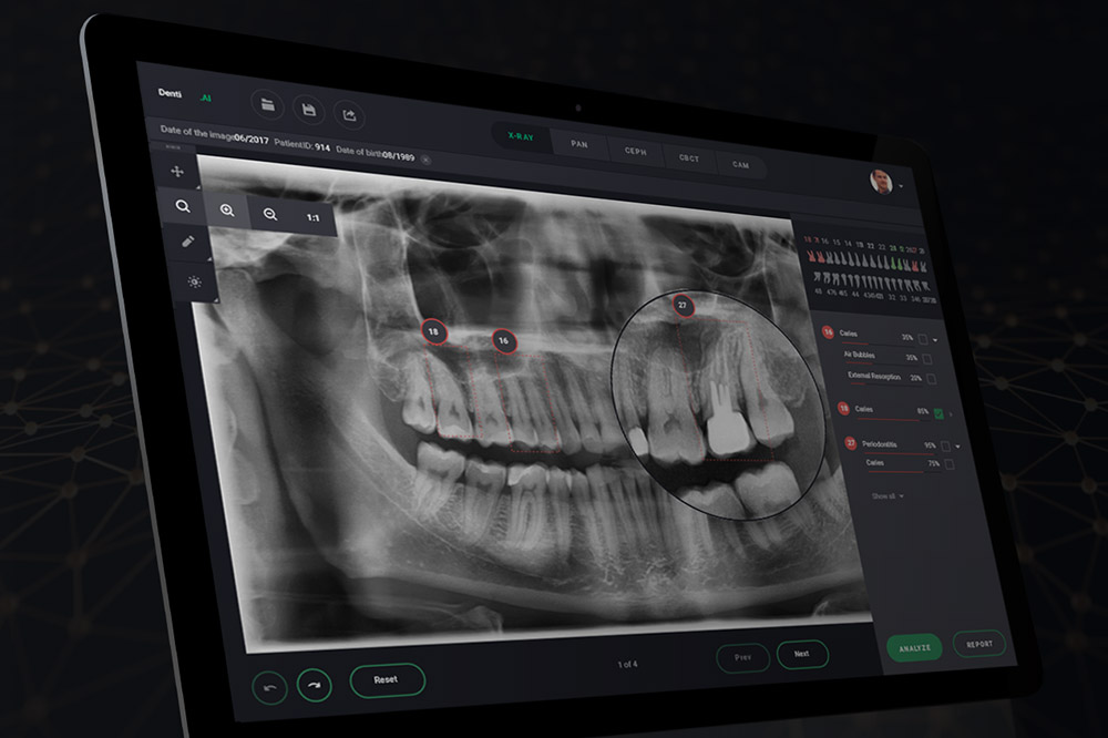 Read more about the article Digitalizacija u ordinaciji dentalne medicine